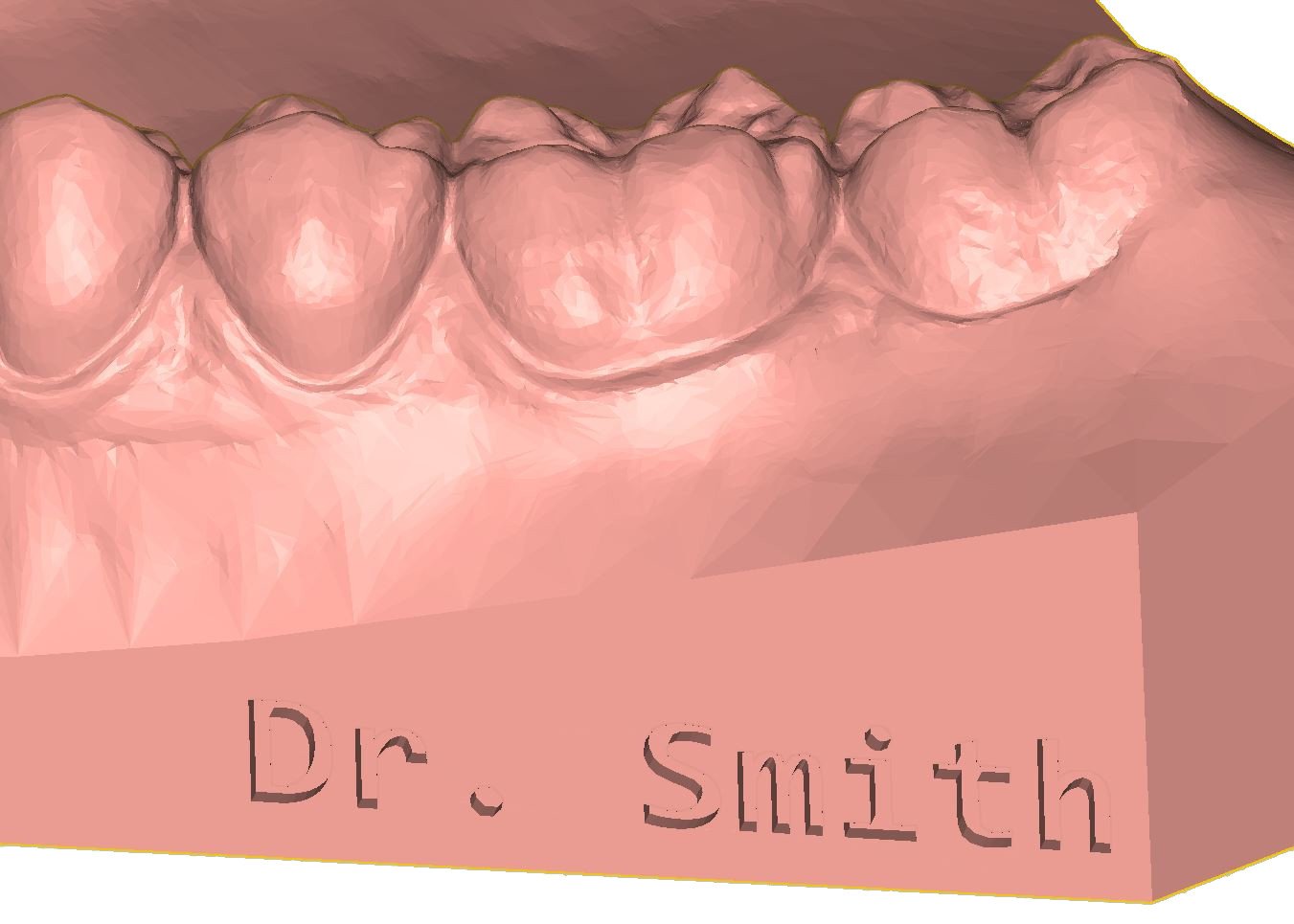 Dr. Smith kazımalı model örneği