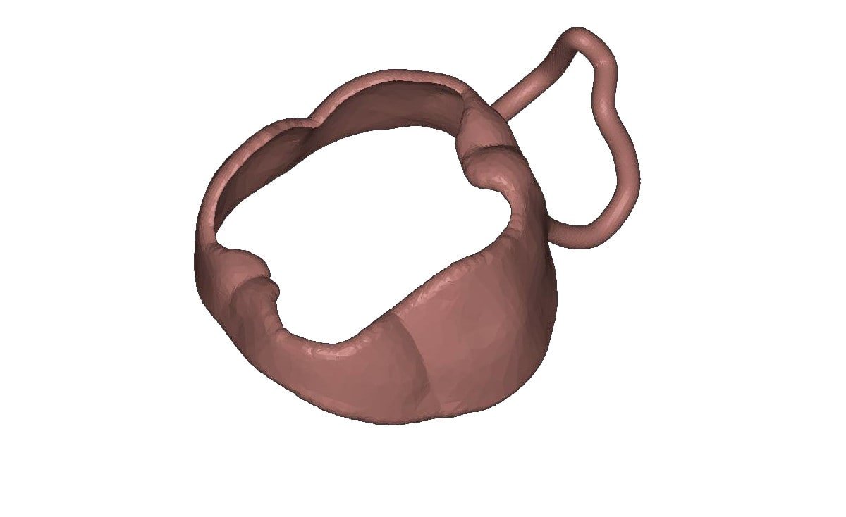 3D tasarlanmış kişiye özel molar bant